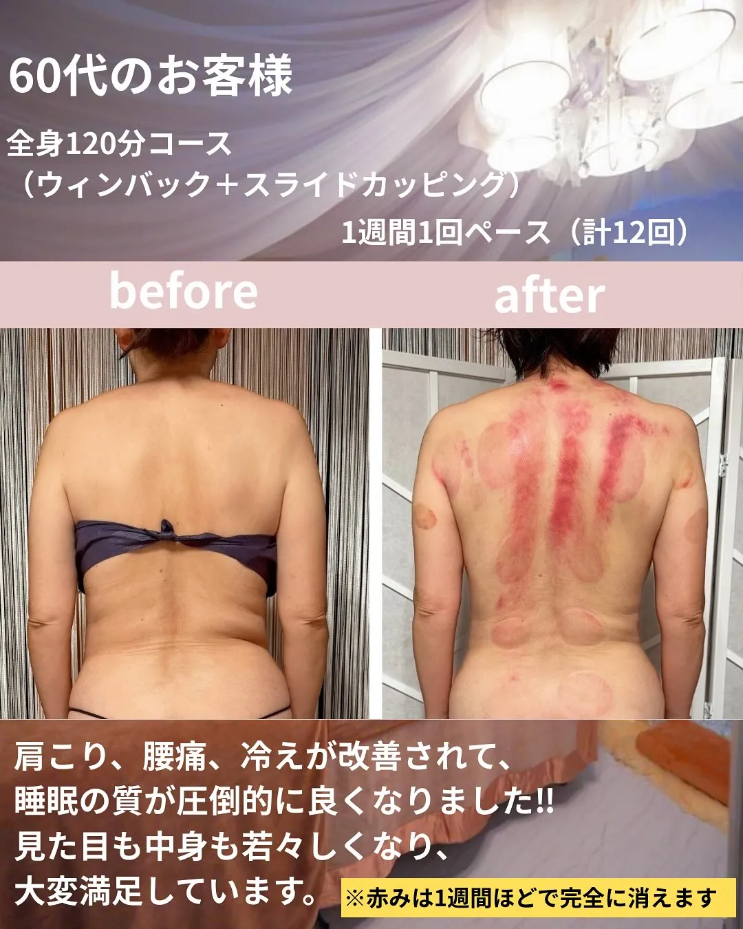 🌿エイジングに特化した痩身＆姿勢改善🌿