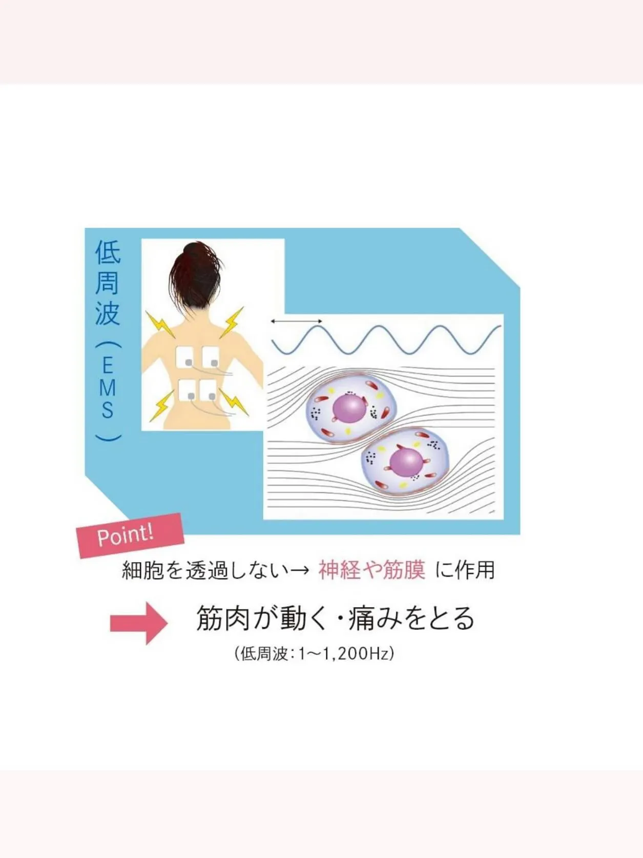 WINBACK 4はアメリカFDA承認を取得している高周波温...