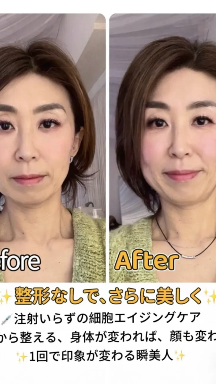 💉細胞注射 vs 当サロンの細胞活性ケア