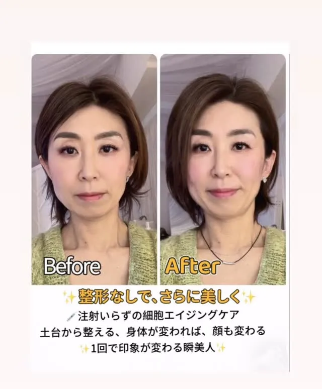 40代、50代のたるみは、放置すれば“定着”する。