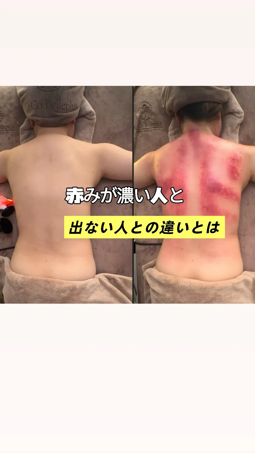 赤みが濃い人ほど、身体は悲鳴を上げているかもしれません。