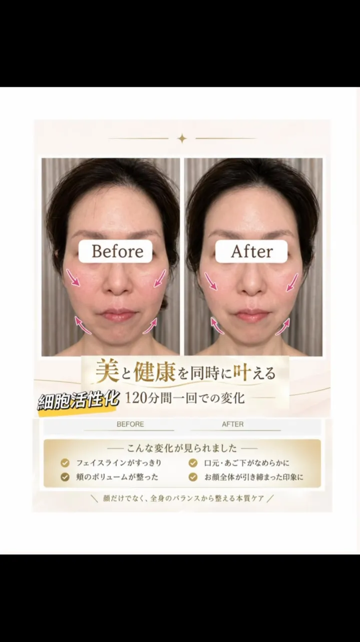 ☆WINBACK 4 × 美骨格姿勢調整☆